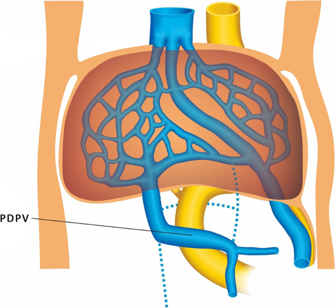 Fistula VVS Icon